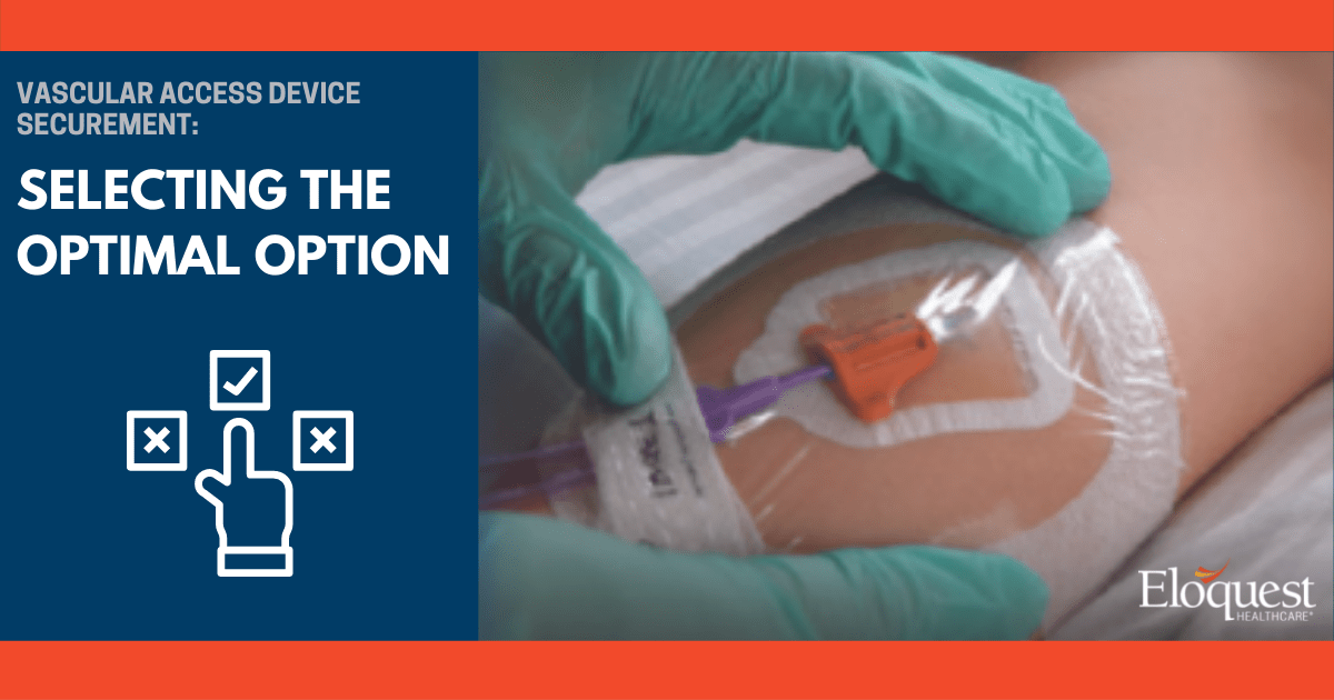 Vascular Access Device Securement: Selecting the Optimal Option