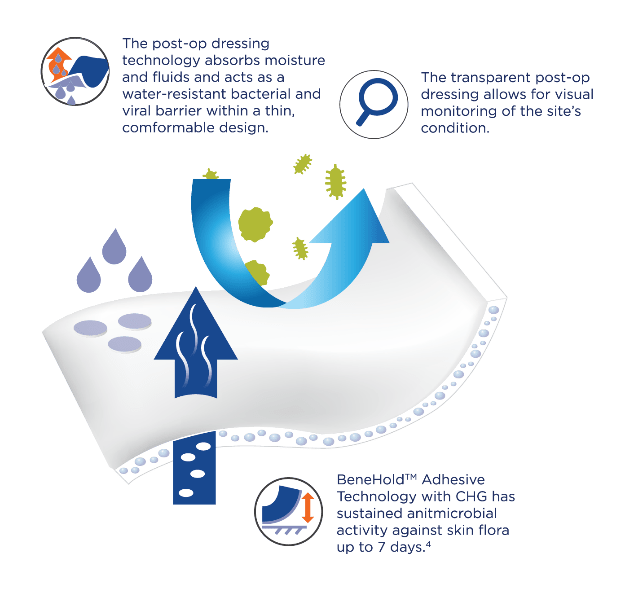 Blog 39 Graphic