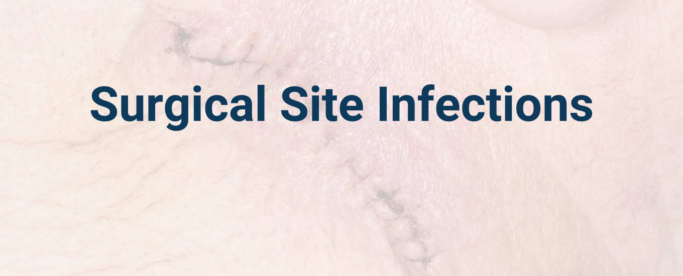 surgical site infection with text overlay surgical site infection