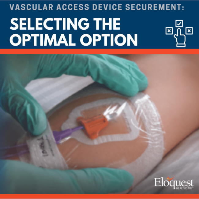 Vascular Access Device Securement: Selecting the Optimal Option Test: Vascular Access Device Securement: Selecting the Optimal Option