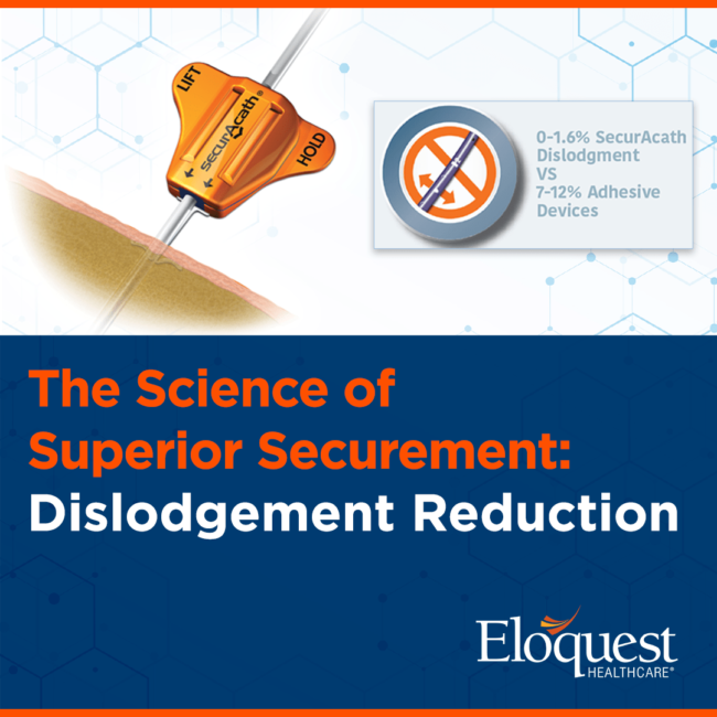 Text: The Science of Superior Securement: Dislodgement Reduction Text: The Science of Superior Securement: Dislodgement Reduction
