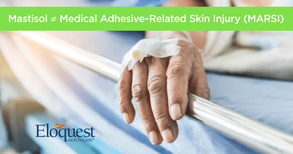 Mastisol ≠ Medical Adhesive Related Skin Injury (MARSI) Eloquest