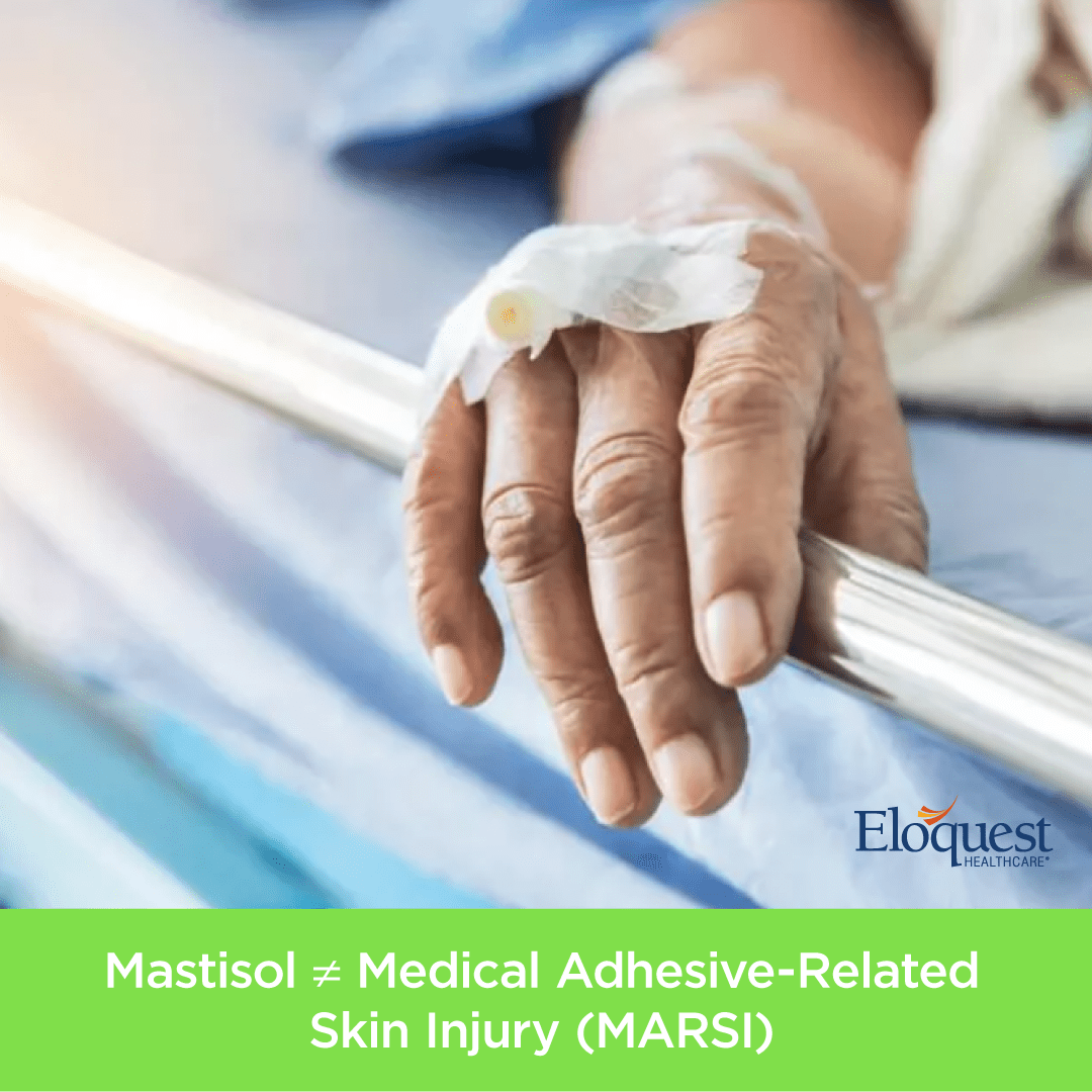 Mastisol Not Equal To Medical Adhesive-Related Skin Injury (MARSI)