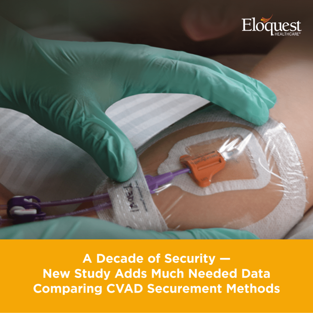 Text: Comparing CVAD Securement Methods