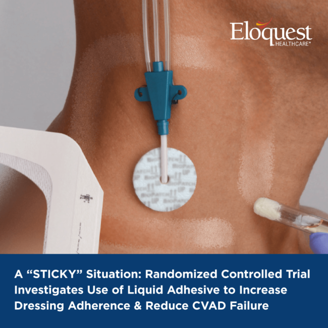 StickySituation_Thumbnail_1080x1080 Randomized Controlled Trial Investigation Use of Liquid Adhesive to Increase Dressing Adherence & Reduce CVAD Failure