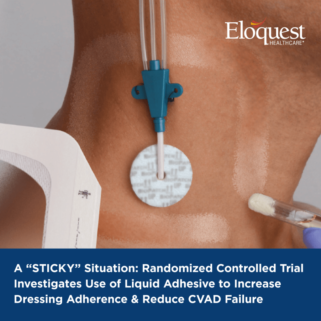 Text: A “STICKY” Situation: Randomized Controlled Trial Investigates Use of Liquid Adhesive to Increase Dressing Adherence & Reduce CVAD Failure