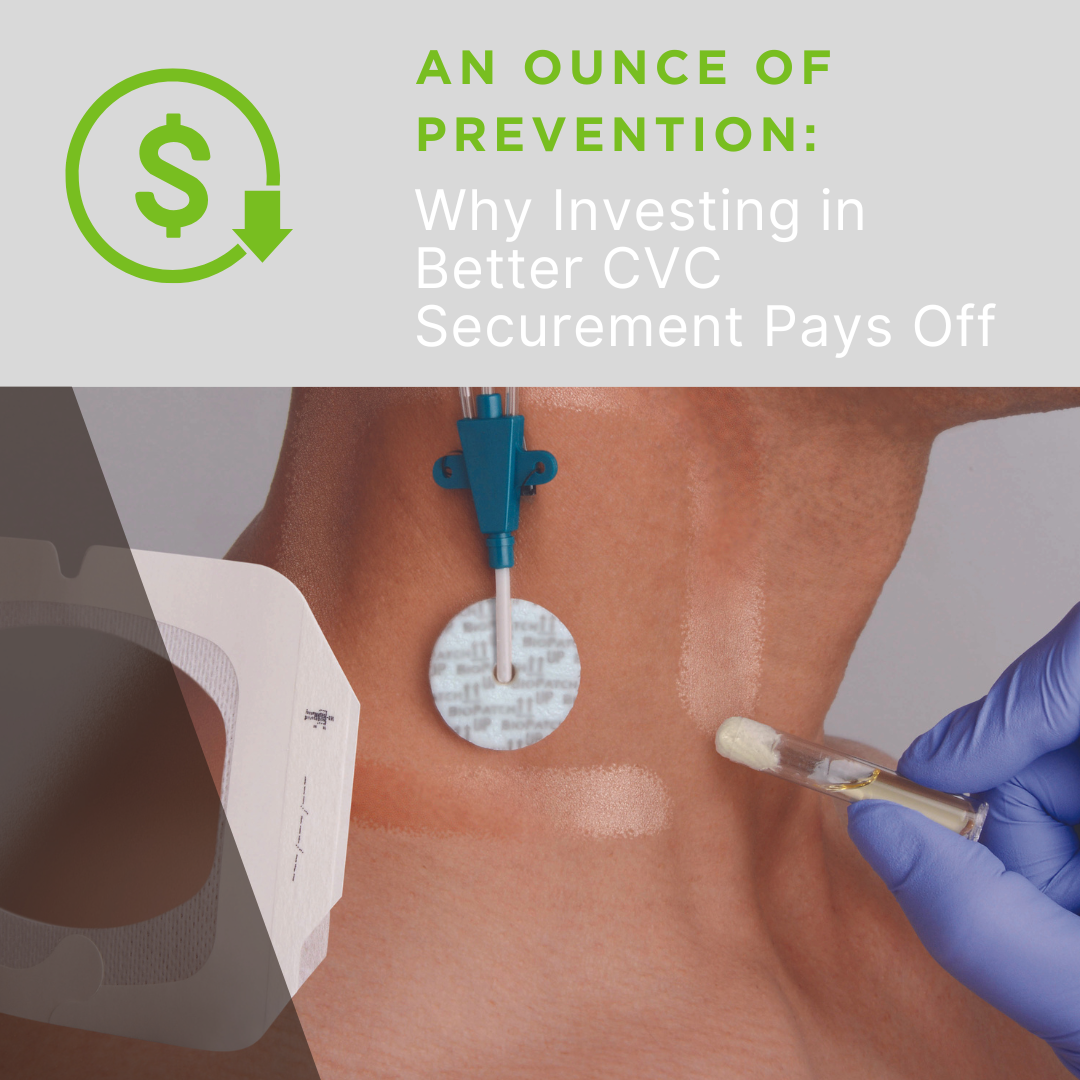 An Ounce of Prevention: Why Investing in Better CVC Securement Pays Off. Featured image includes a jugular CVC site with Mastisol Liquid Adhesive being applied.