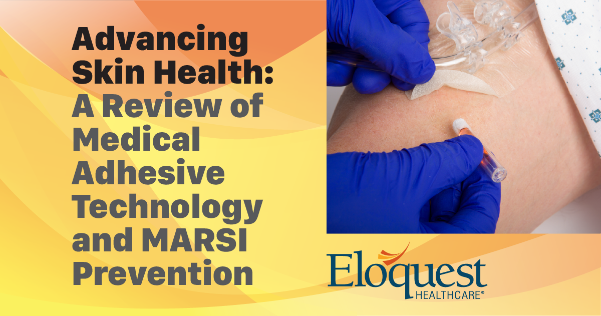 Blog 195 MARSI Header